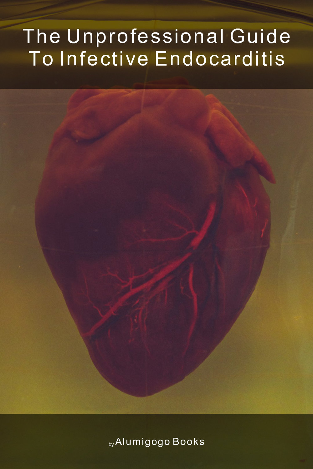 Cover of The Unprofessional Guide to infective endocarditis