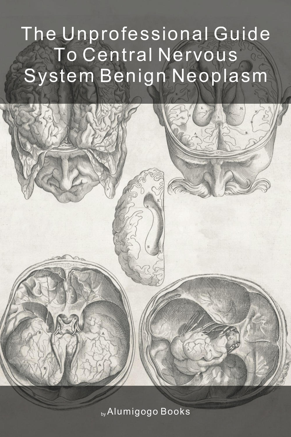 Cover of The Unprofessional Guide to central nervous system benign neoplasm