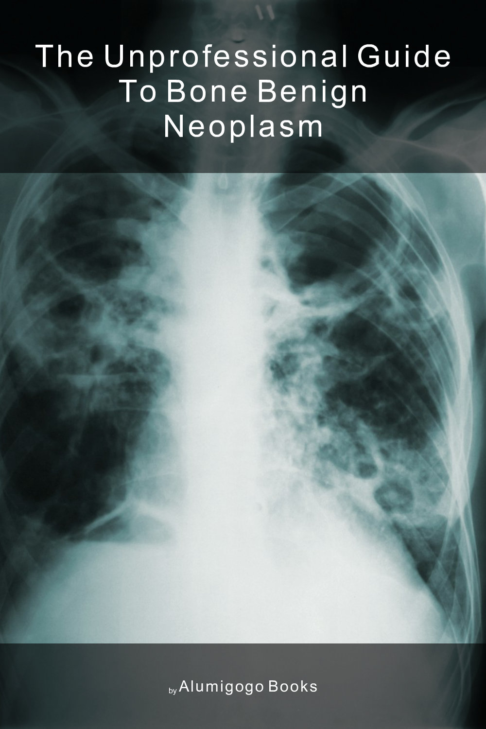 Cover of The Unprofessional Guide to bone benign neoplasm
