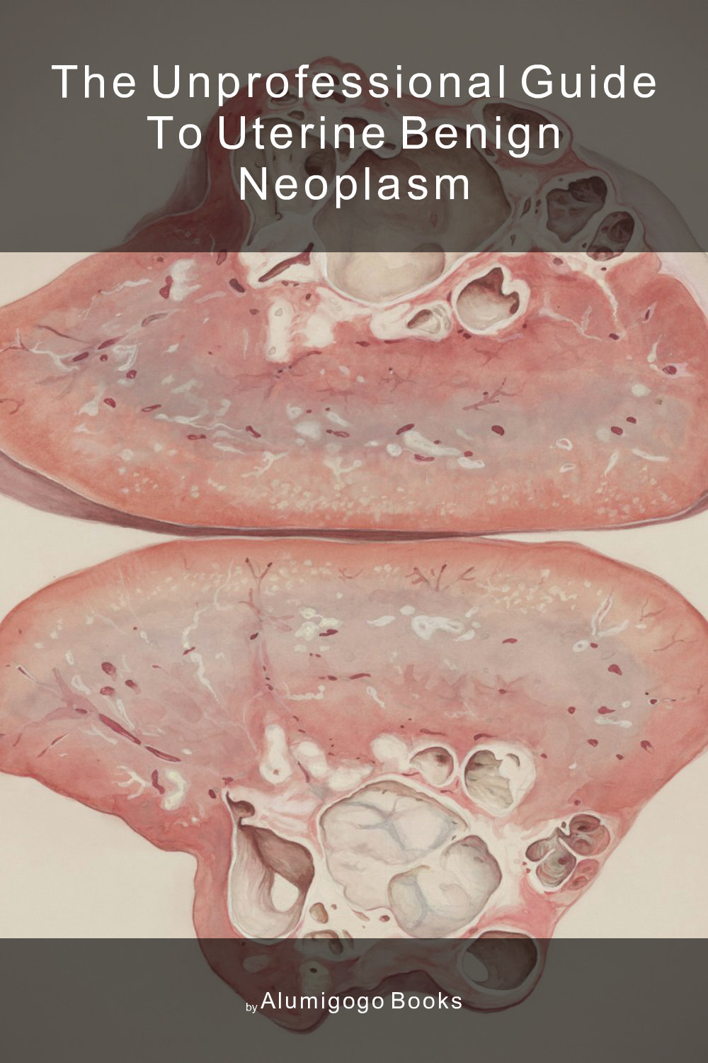 Cover of The Unprofessional Guide to uterine benign neoplasm