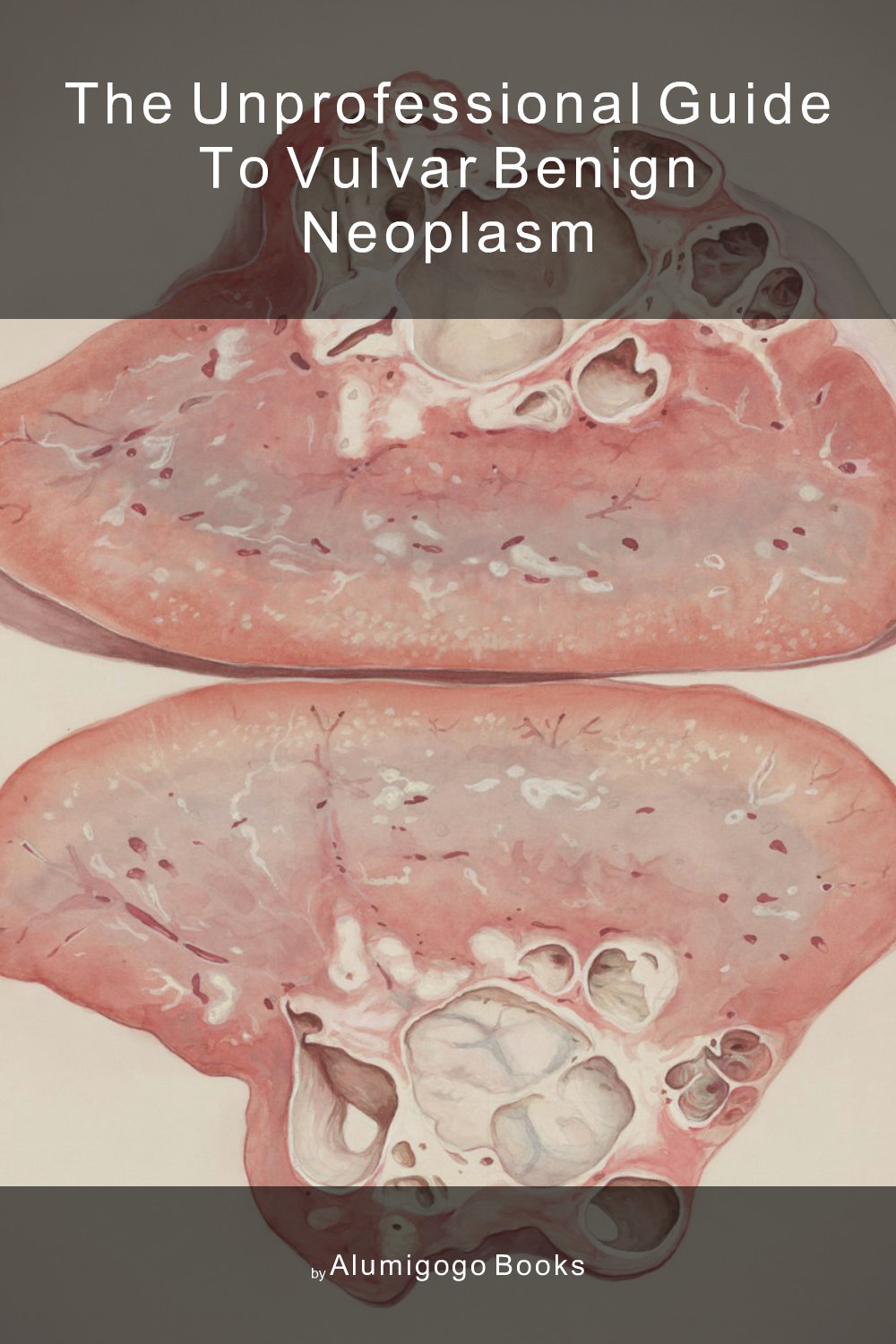 Cover of The Unprofessional Guide to vulvar benign neoplasm