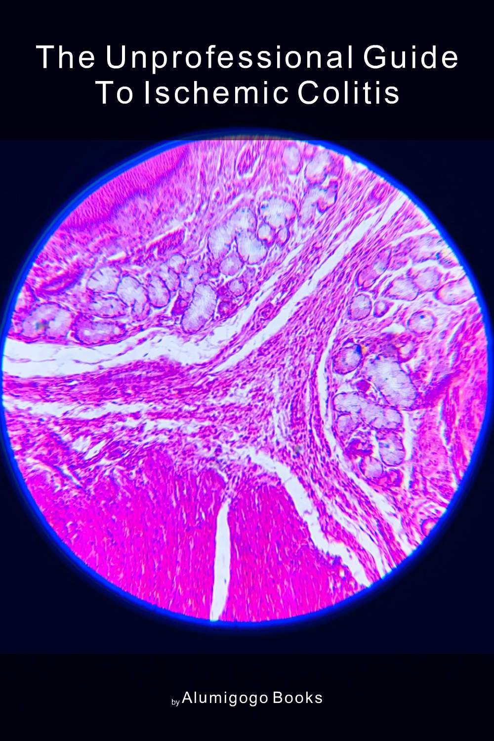 Cover of The Unprofessional Guide to ischemic colitis