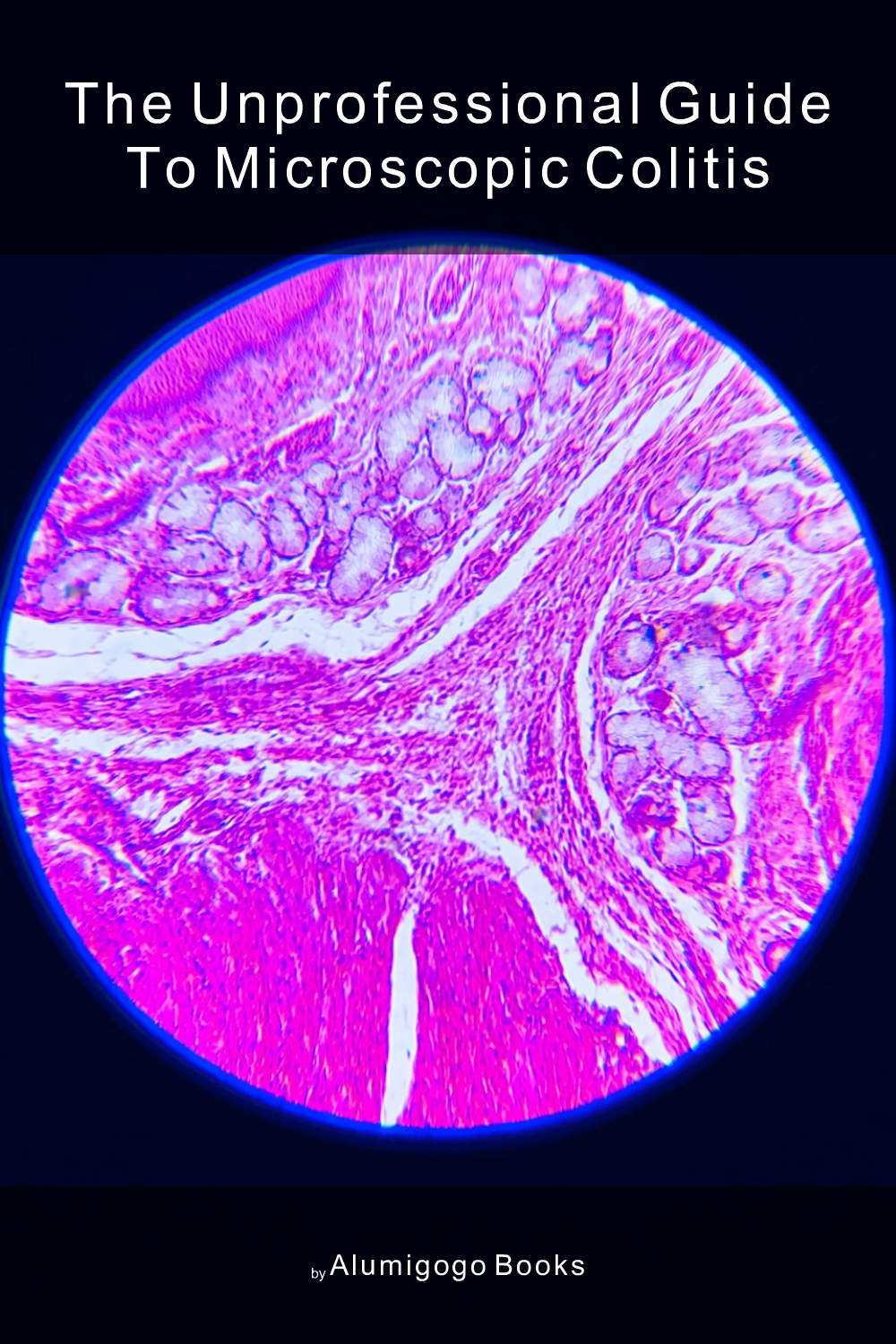 Cover of The Unprofessional Guide to microscopic colitis