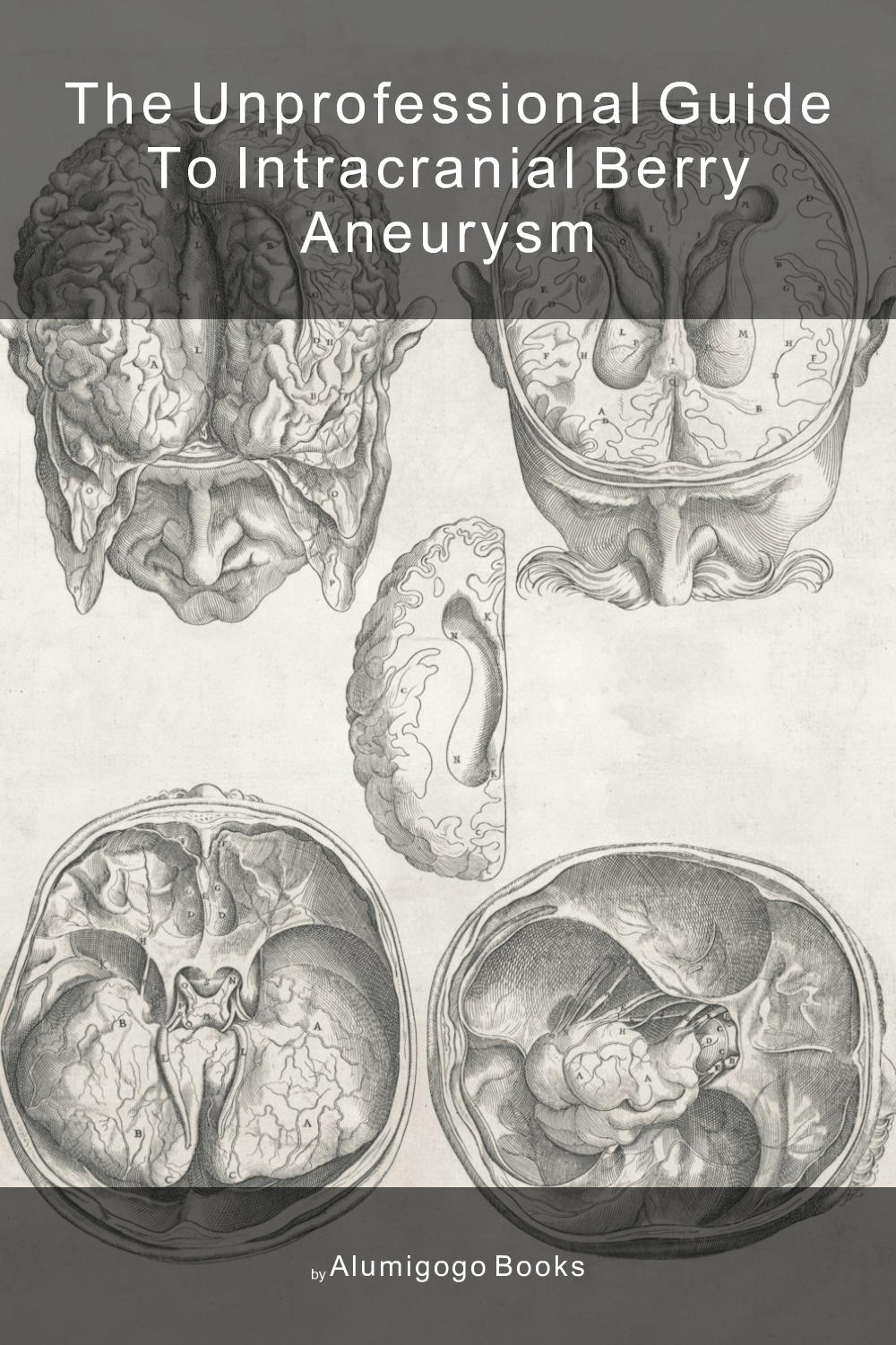 Cover of The Unprofessional Guide to intracranial berry aneurysm
