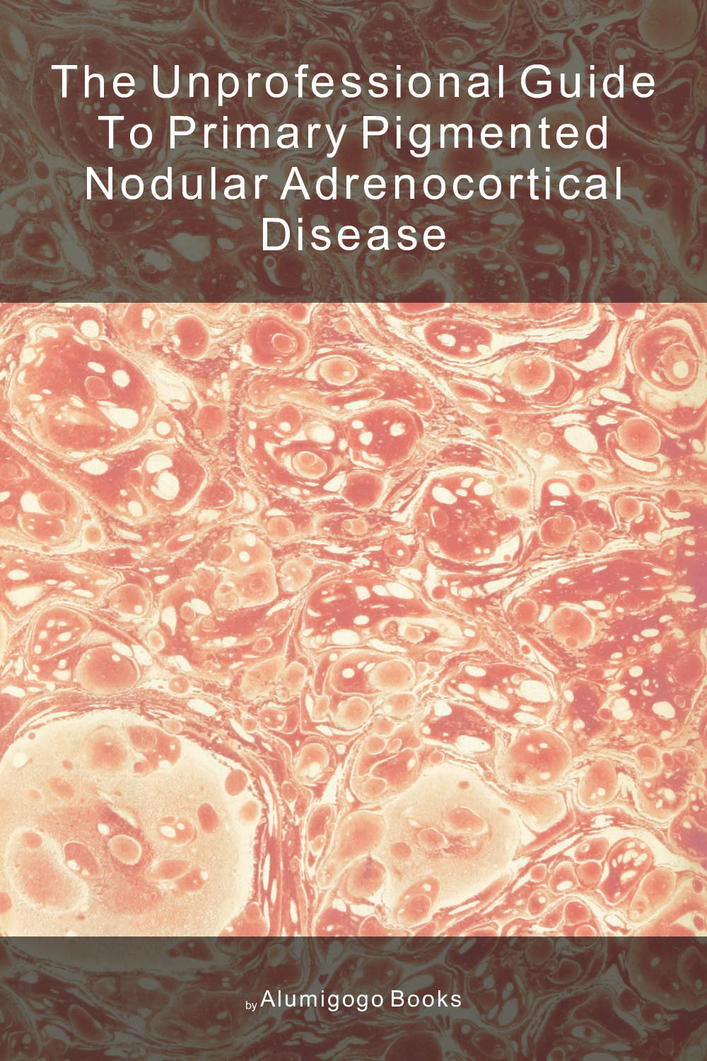 Cover of The Unprofessional Guide to primary pigmented nodular adrenocortical disease