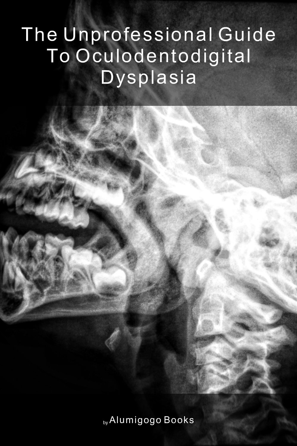 Cover of The Unprofessional Guide to oculodentodigital dysplasia