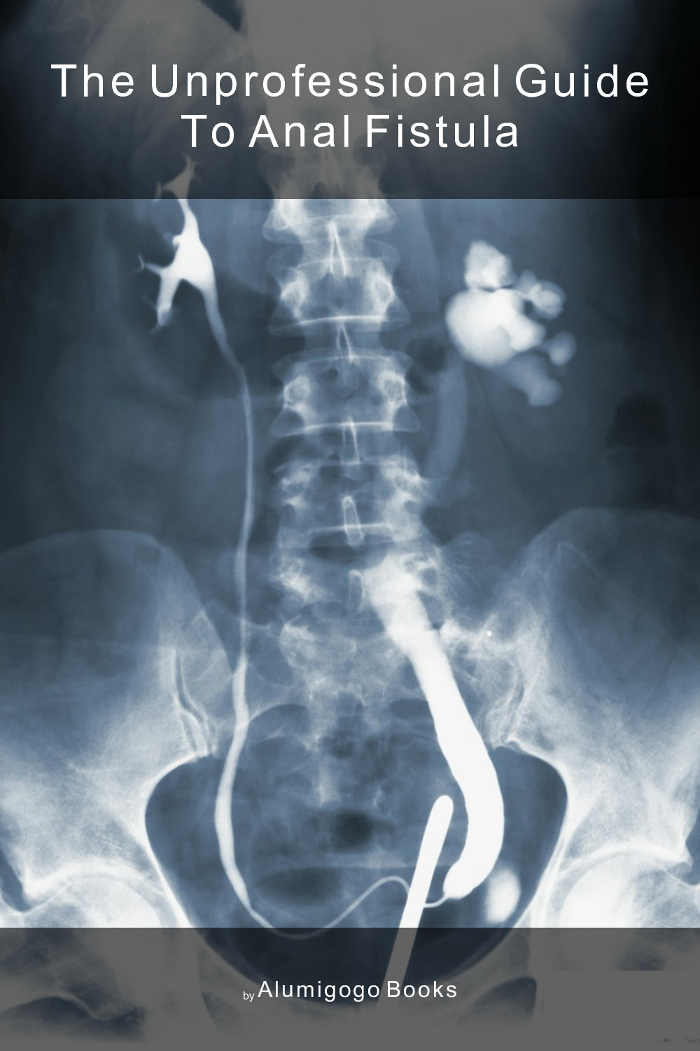 Cover of The Unprofessional Guide to anal fistula