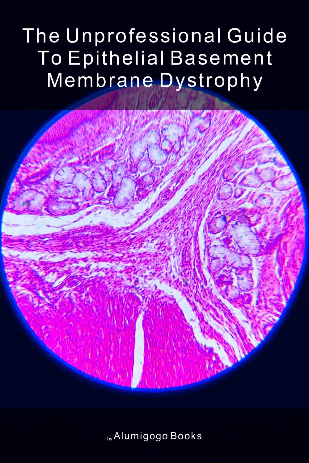Cover of The Unprofessional Guide to epithelial basement membrane dystrophy