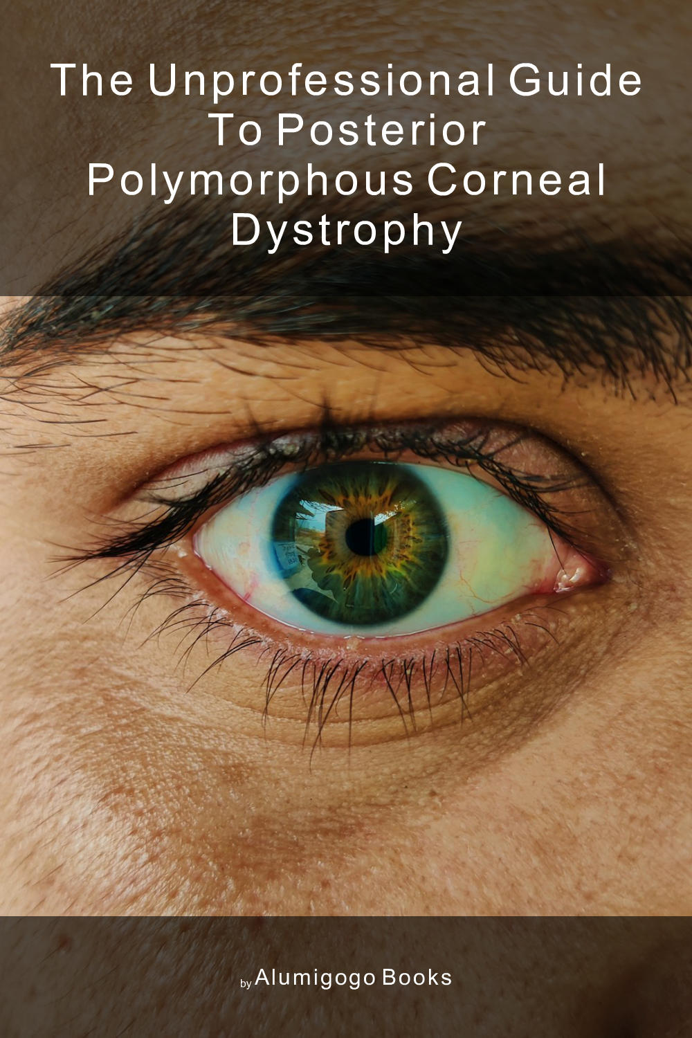 Cover of The Unprofessional Guide to posterior polymorphous corneal dystrophy