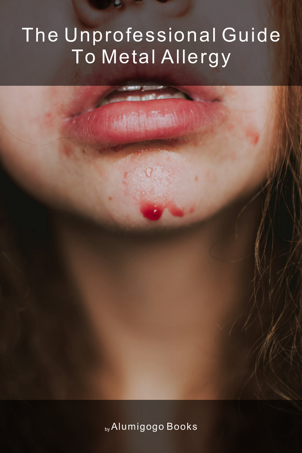 Cover of The Unprofessional Guide to metal allergy