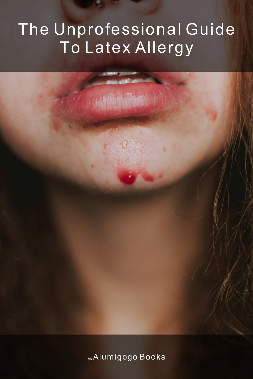 Cover of The Unprofessional Guide to latex allergy