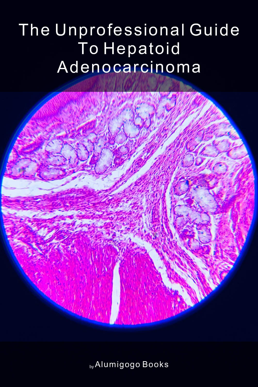 Cover of The Unprofessional Guide to hepatoid adenocarcinoma