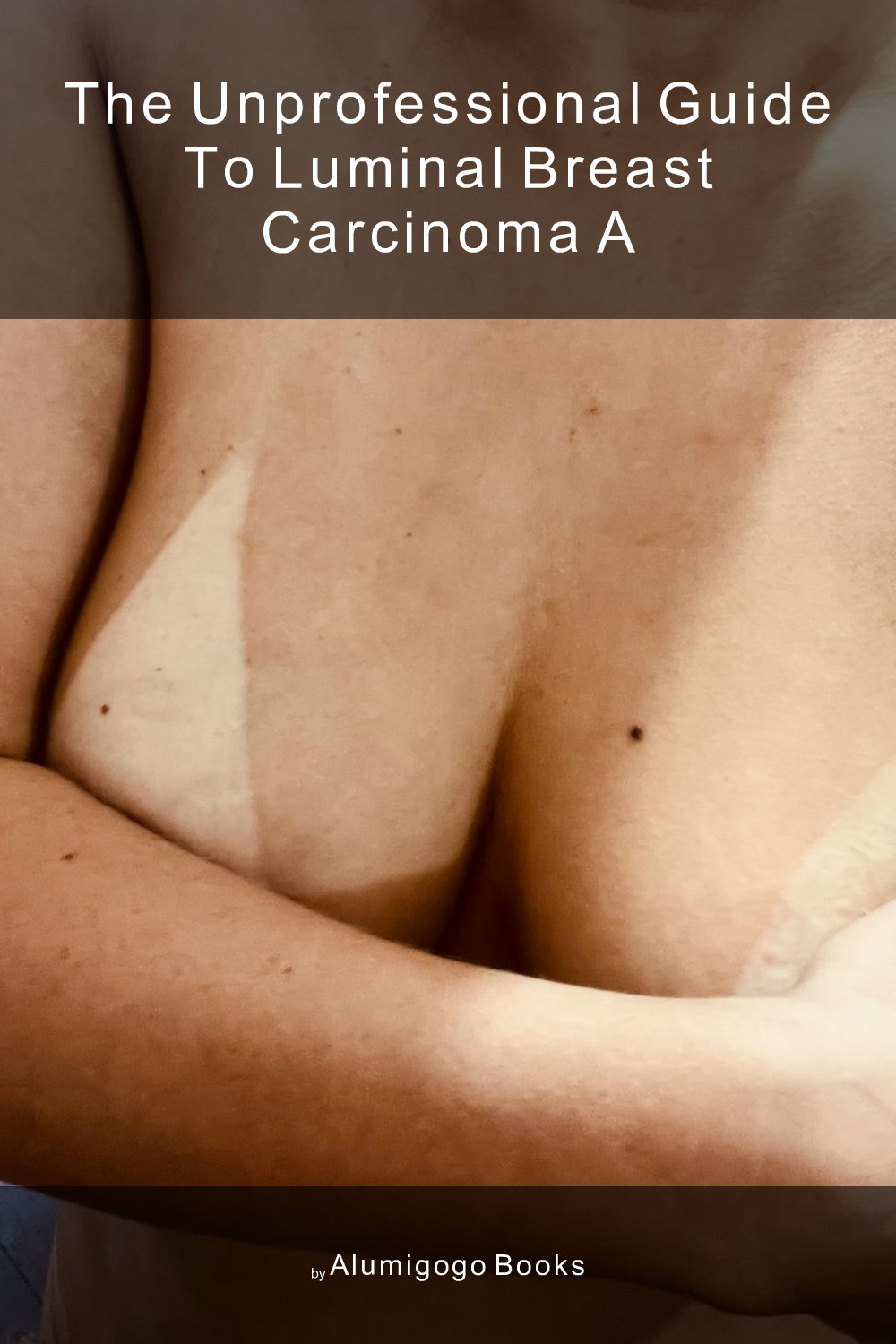 Cover of The Unprofessional Guide to luminal breast carcinoma A