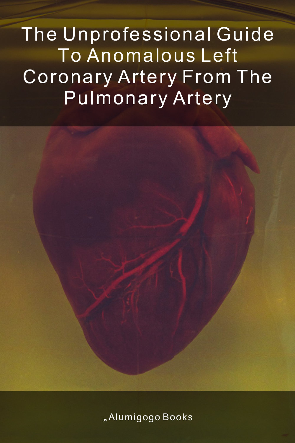 Cover of The Unprofessional Guide to anomalous left coronary artery from the pulmonary artery