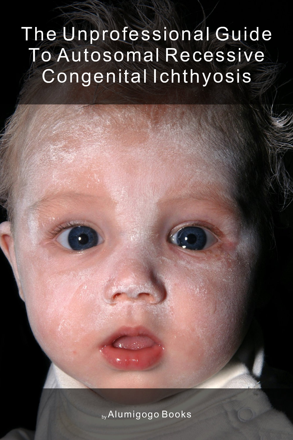 Cover of The Unprofessional Guide to autosomal recessive congenital ichthyosis