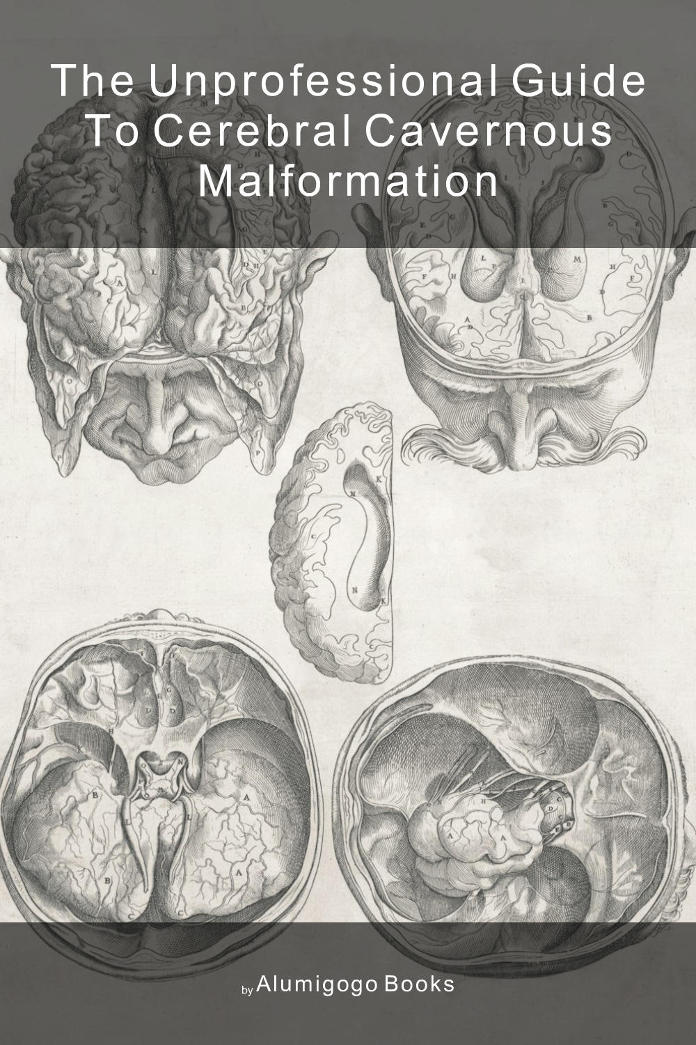 Cover of The Unprofessional Guide to cerebral cavernous malformation