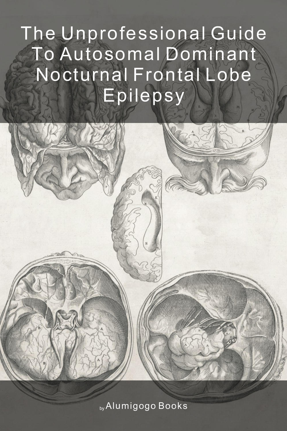 Cover of The Unprofessional Guide to autosomal dominant nocturnal frontal lobe epilepsy