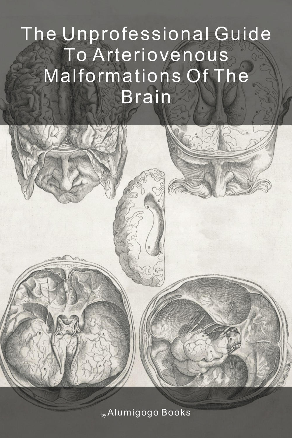 Cover of The Unprofessional Guide to arteriovenous malformations of the brain