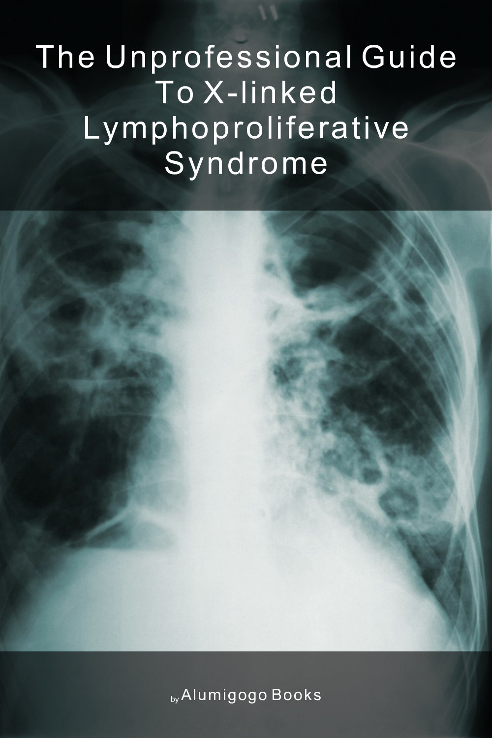 Cover of The Unprofessional Guide to X-linked lymphoproliferative syndrome