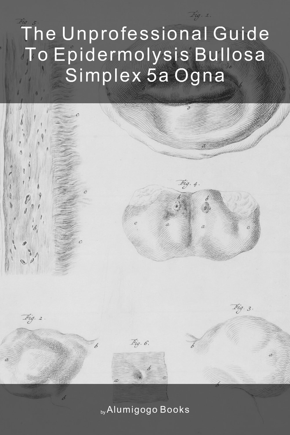 Cover of The Unprofessional Guide to epidermolysis bullosa simplex 5A Ogna