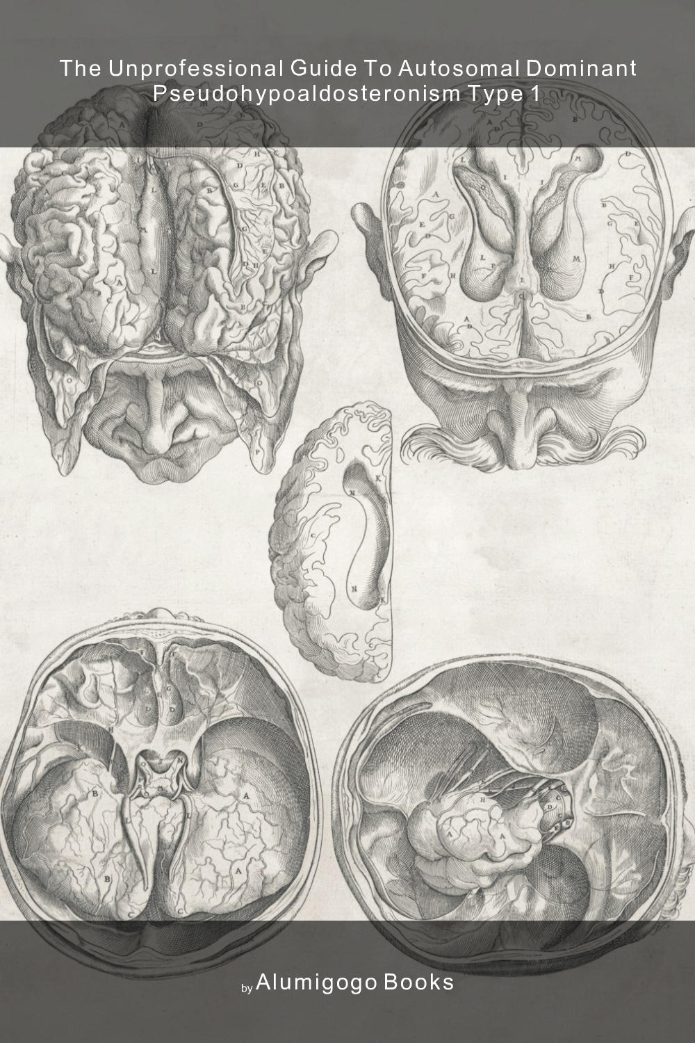 Cover of The Unprofessional Guide to autosomal dominant pseudohypoaldosteronism type 1