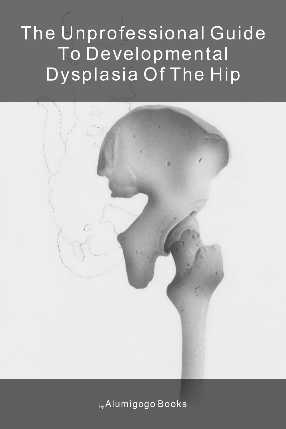 Cover of The Unprofessional Guide to developmental dysplasia of the hip