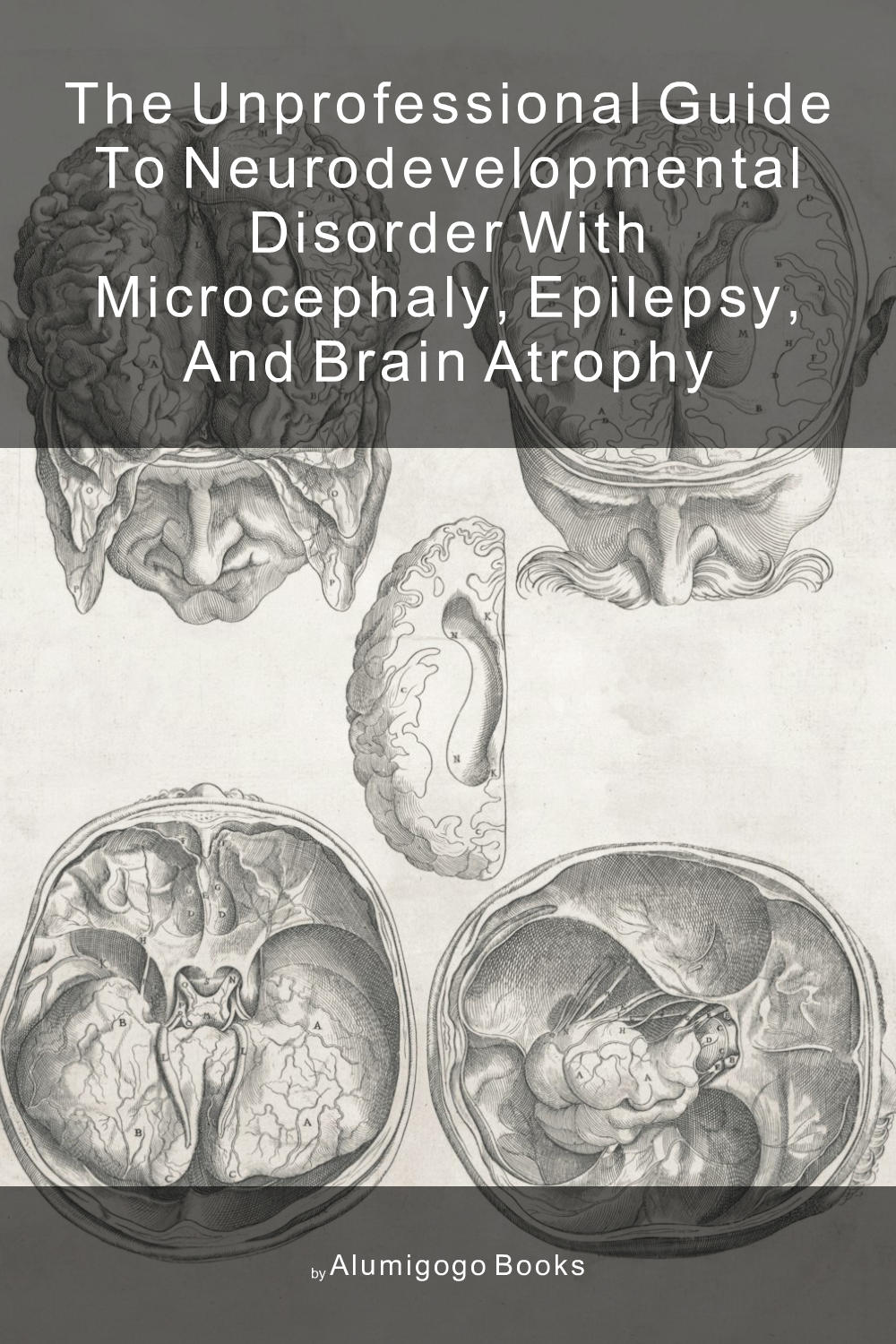 Cover of The Unprofessional Guide to neurodevelopmental disorder with microcephaly, epilepsy, and brain atrophy
