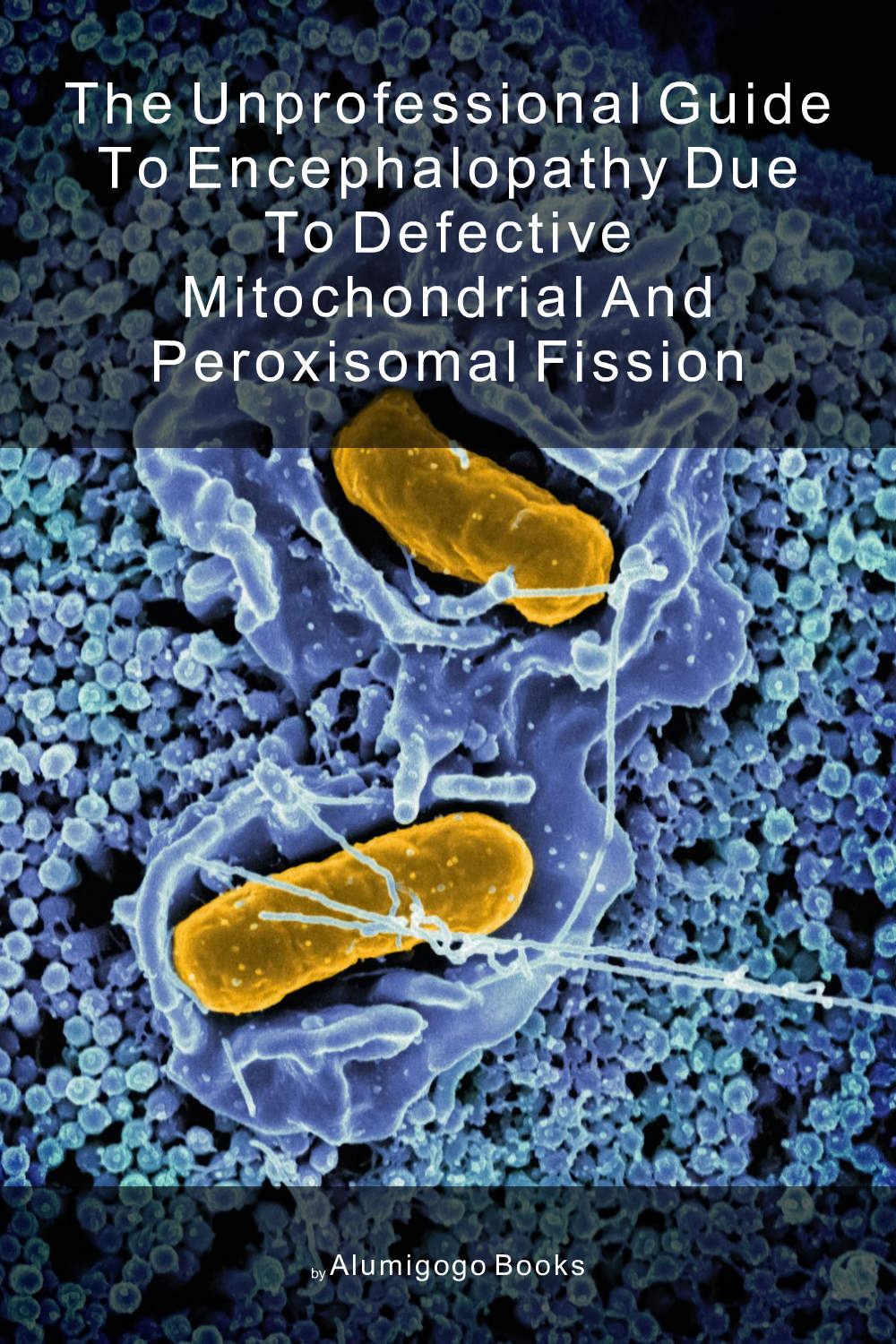 Cover of The Unprofessional Guide to encephalopathy due to defective mitochondrial and peroxisomal fission