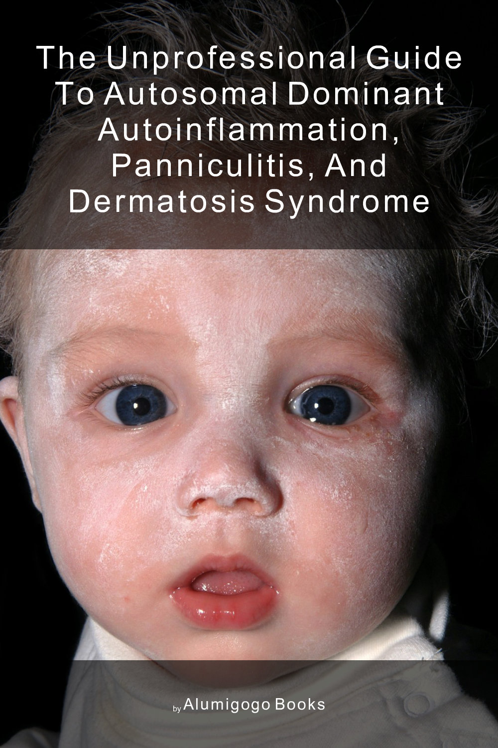 Cover of The Unprofessional Guide to autosomal dominant autoinflammation, panniculitis, and dermatosis syndrome