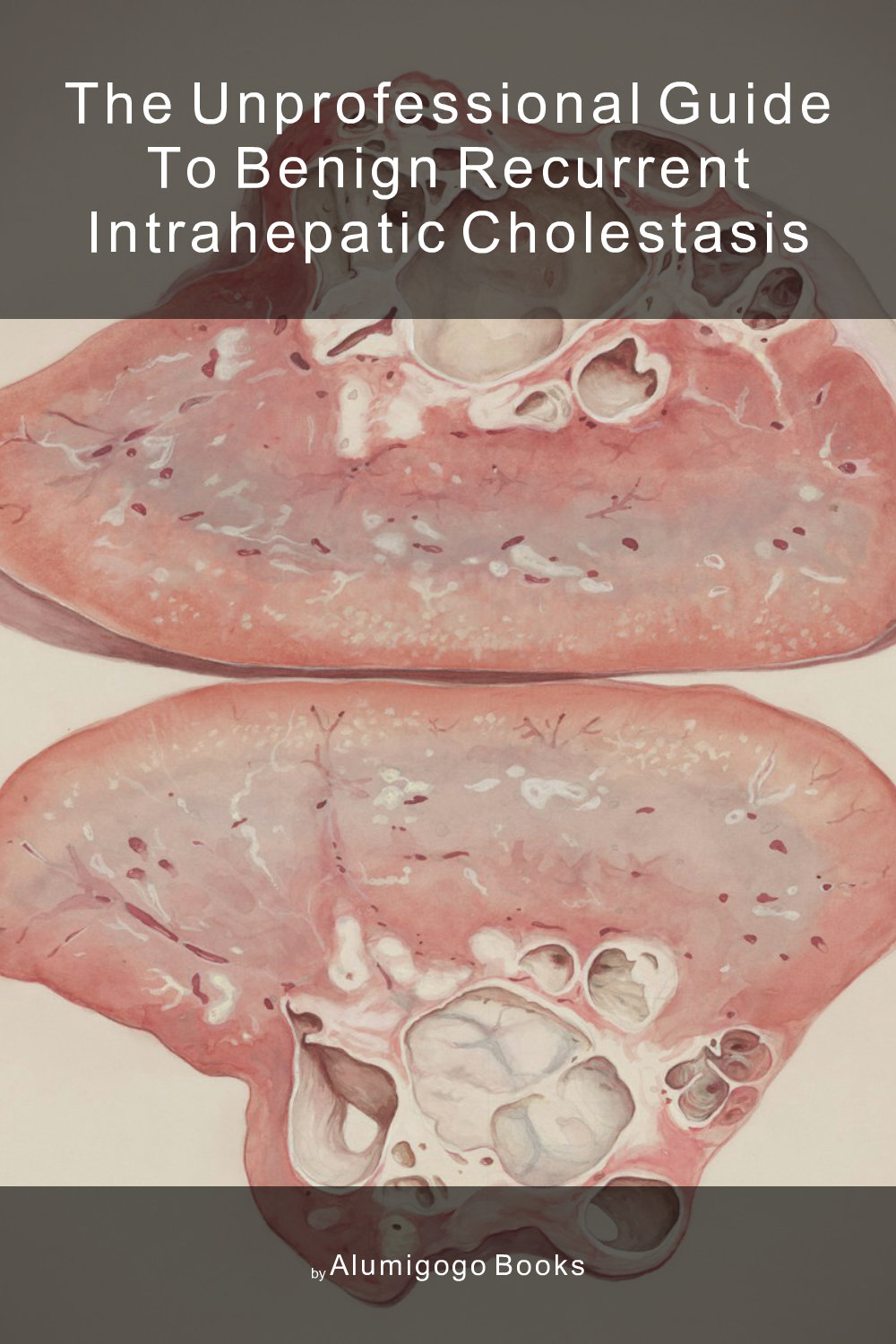 Cover of The Unprofessional Guide to benign recurrent intrahepatic cholestasis