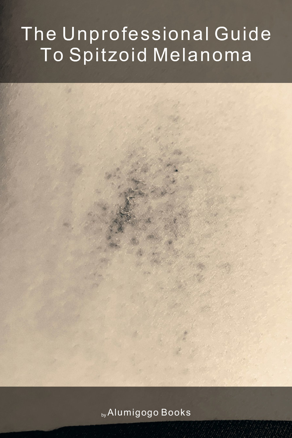 Cover of The Unprofessional Guide to spitzoid melanoma