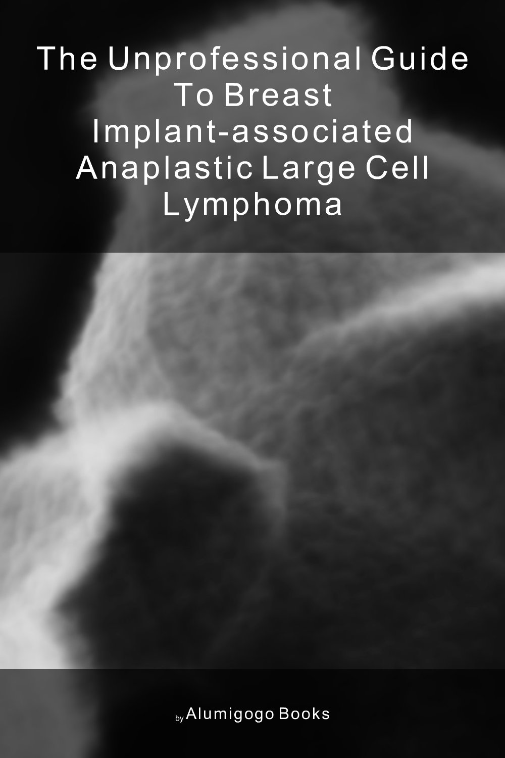 Cover of The Unprofessional Guide to breast implant-associated anaplastic large cell lymphoma