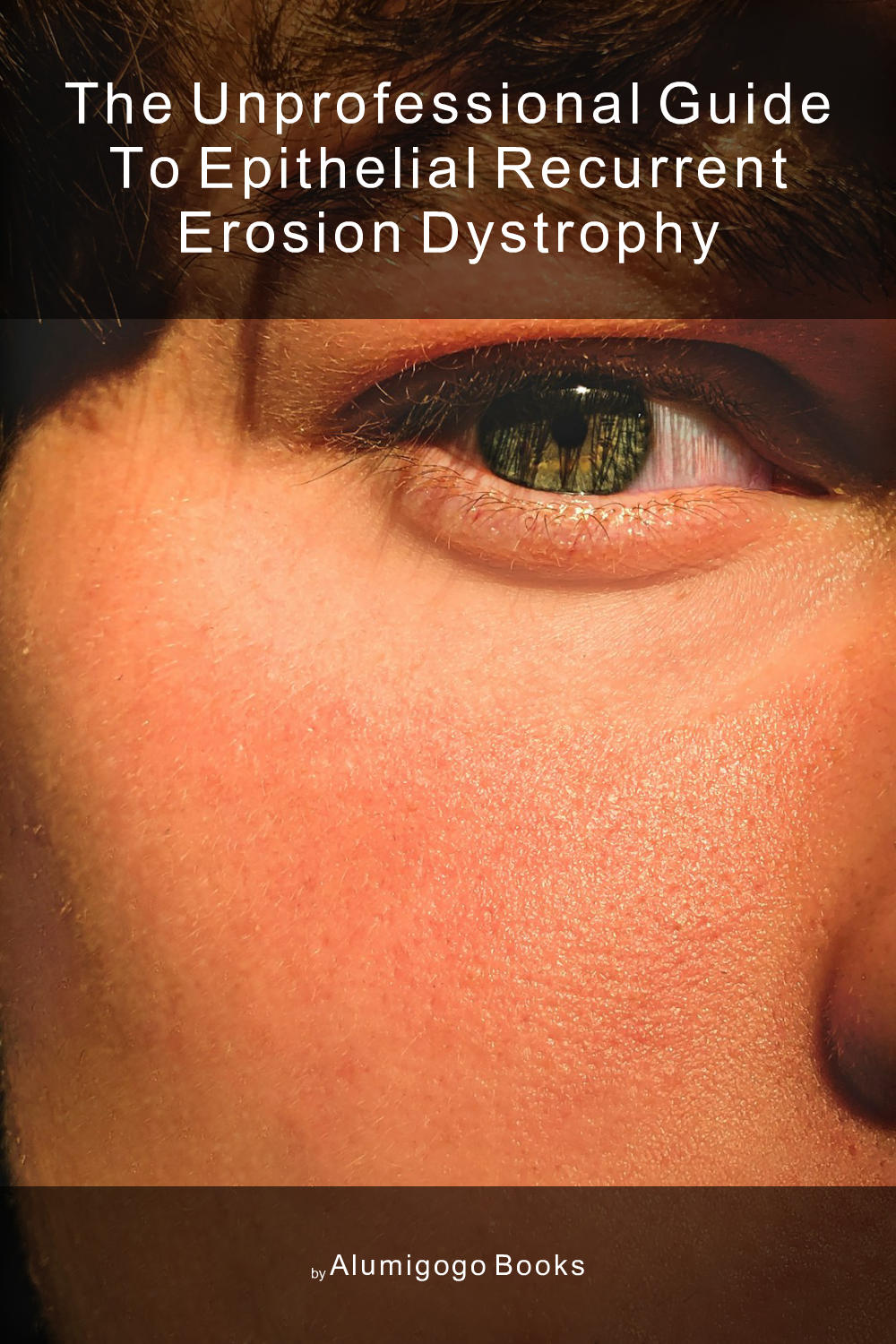 Cover of The Unprofessional Guide to epithelial recurrent erosion dystrophy