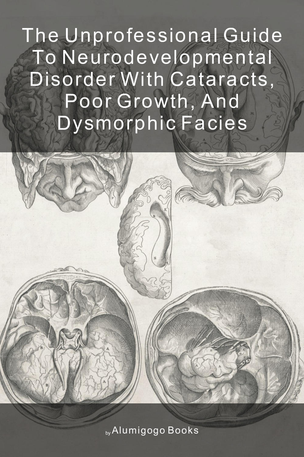 Cover of The Unprofessional Guide to neurodevelopmental disorder with cataracts, poor growth, and dysmorphic facies