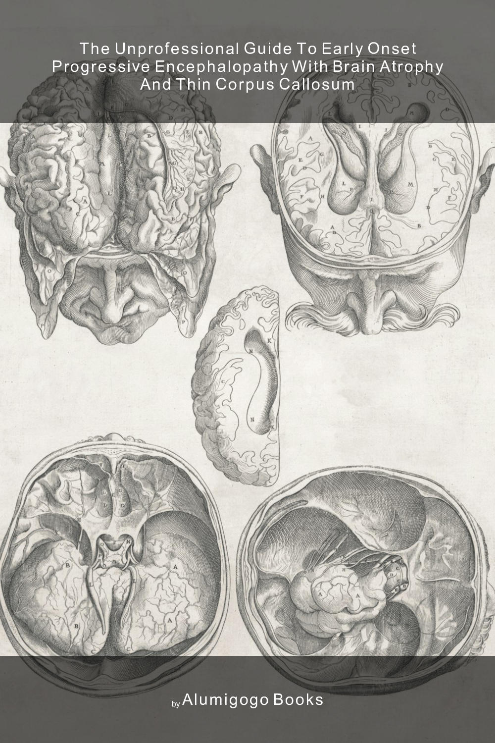 Cover of The Unprofessional Guide to early onset progressive encephalopathy with brain atrophy and thin corpus callosum