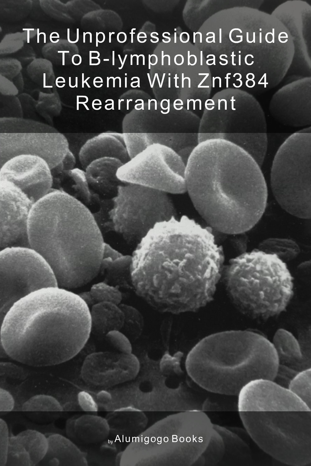 Cover of The Unprofessional Guide to B-lymphoblastic leukemia with ZNF384 rearrangement