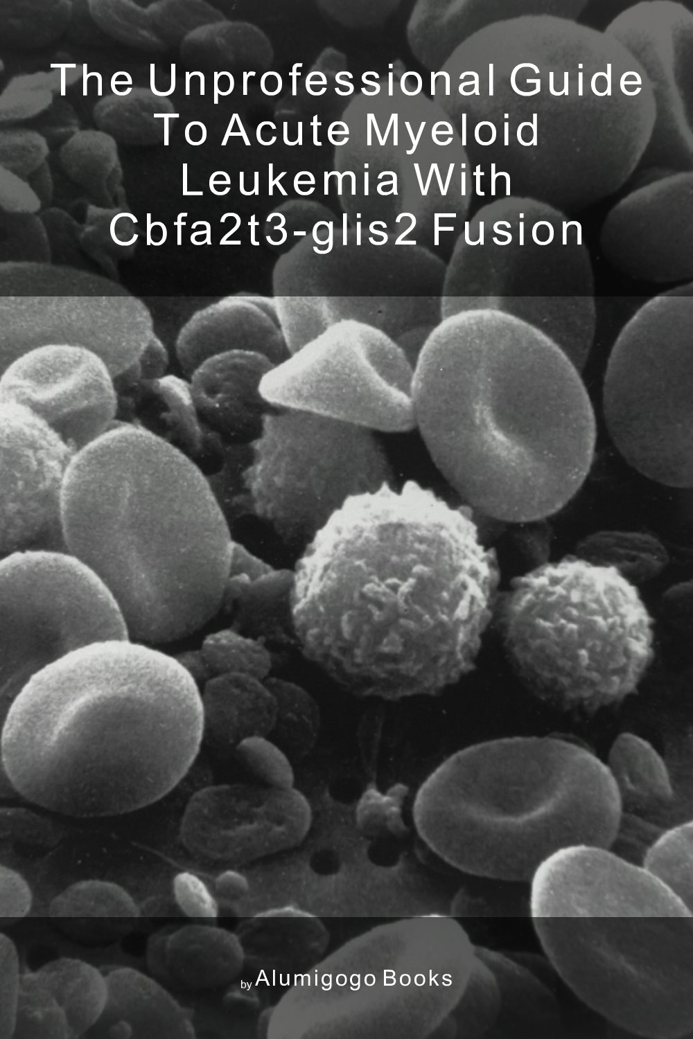 Cover of The Unprofessional Guide to acute myeloid leukemia with CBFA2T3-GLIS2 fusion