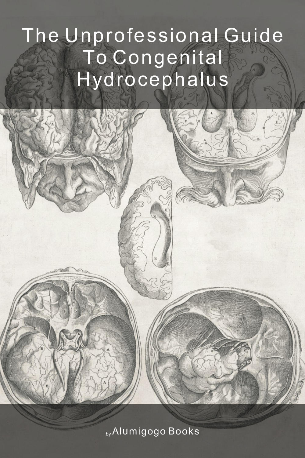 Cover of The Unprofessional Guide to congenital hydrocephalus
