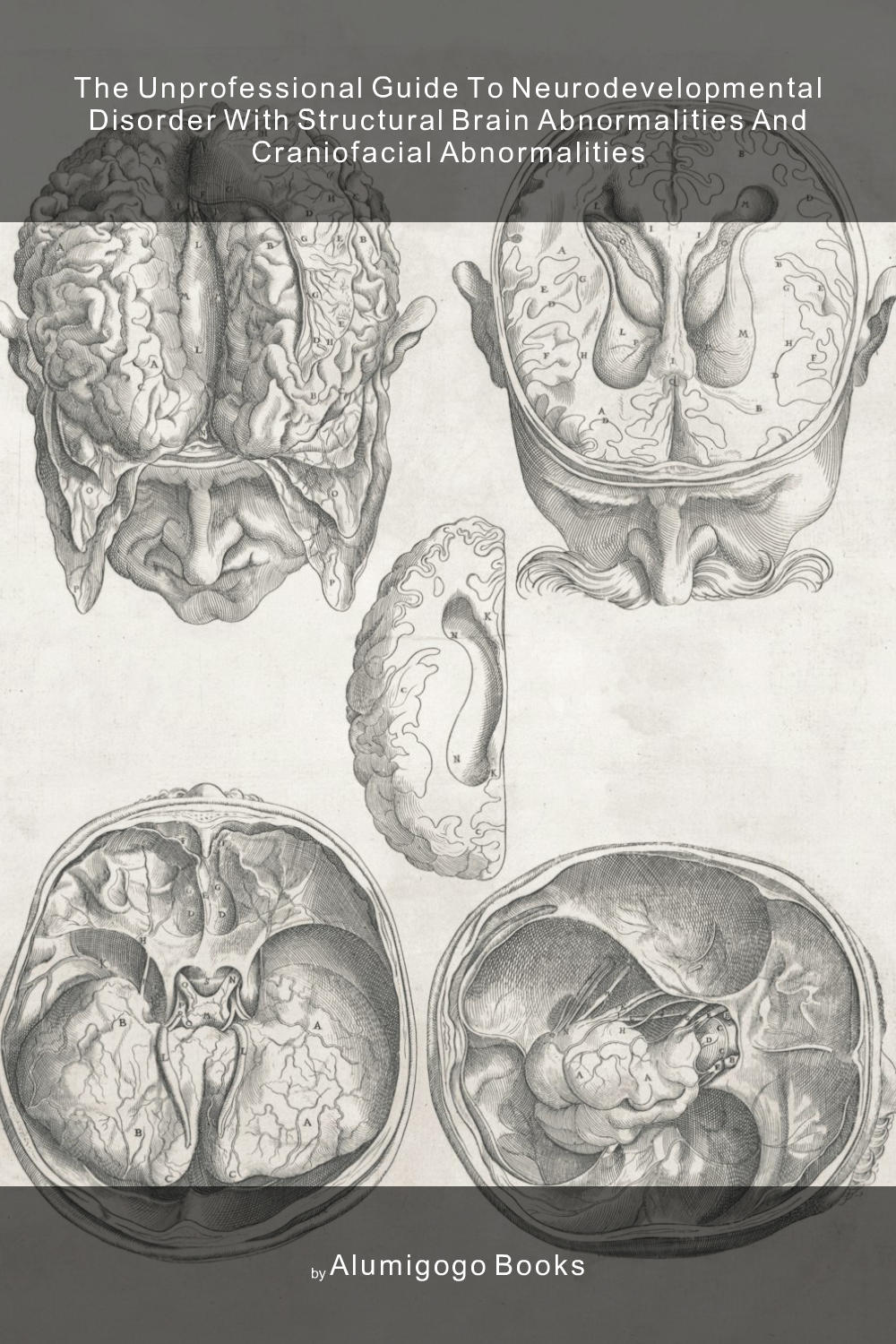 Cover of The Unprofessional Guide to neurodevelopmental disorder with structural brain abnormalities and craniofacial abnormalities