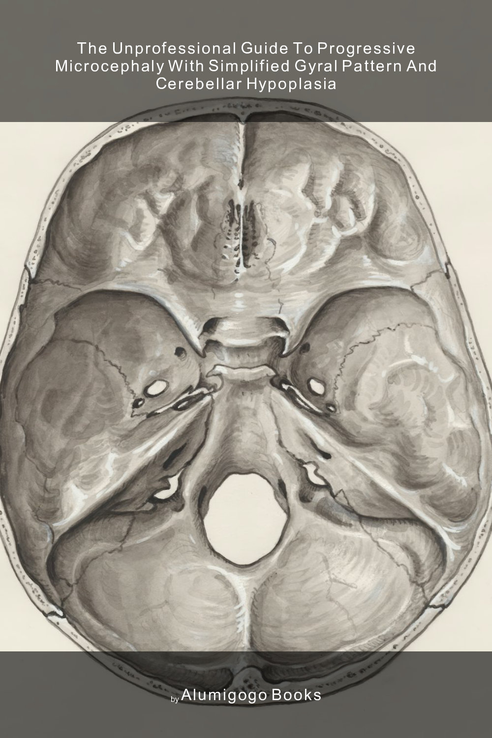 Cover of The Unprofessional Guide to progressive microcephaly with simplified gyral pattern and cerebellar hypoplasia
