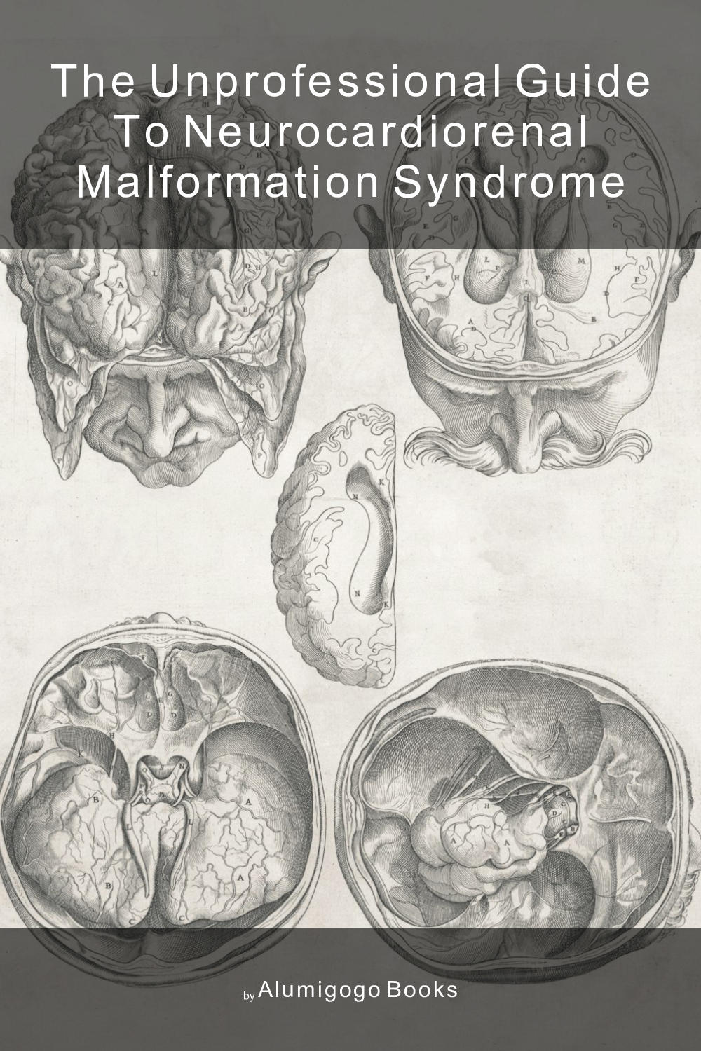 Cover of The Unprofessional Guide to neurocardiorenal malformation syndrome