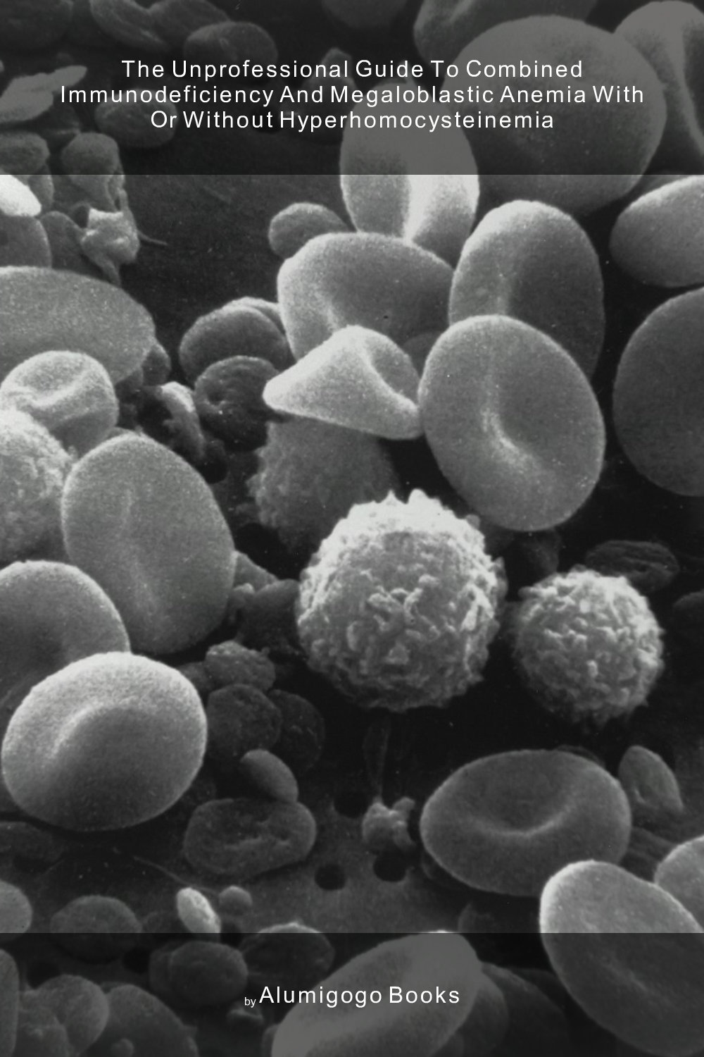 Cover of The Unprofessional Guide to combined immunodeficiency and megaloblastic anemia with or without hyperhomocysteinemia