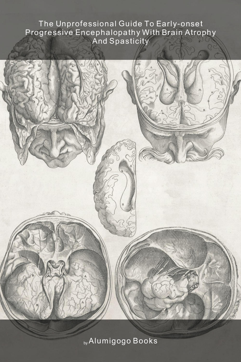 Cover of The Unprofessional Guide to early-onset progressive encephalopathy with brain atrophy and spasticity