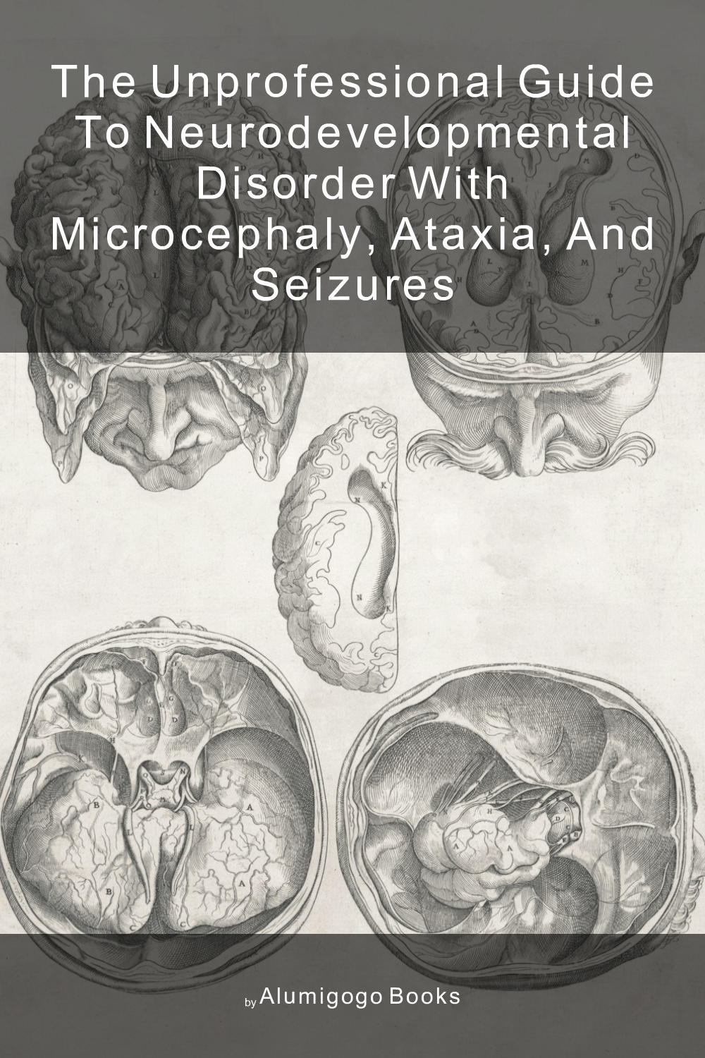 Cover of The Unprofessional Guide to neurodevelopmental disorder with microcephaly, ataxia, and seizures