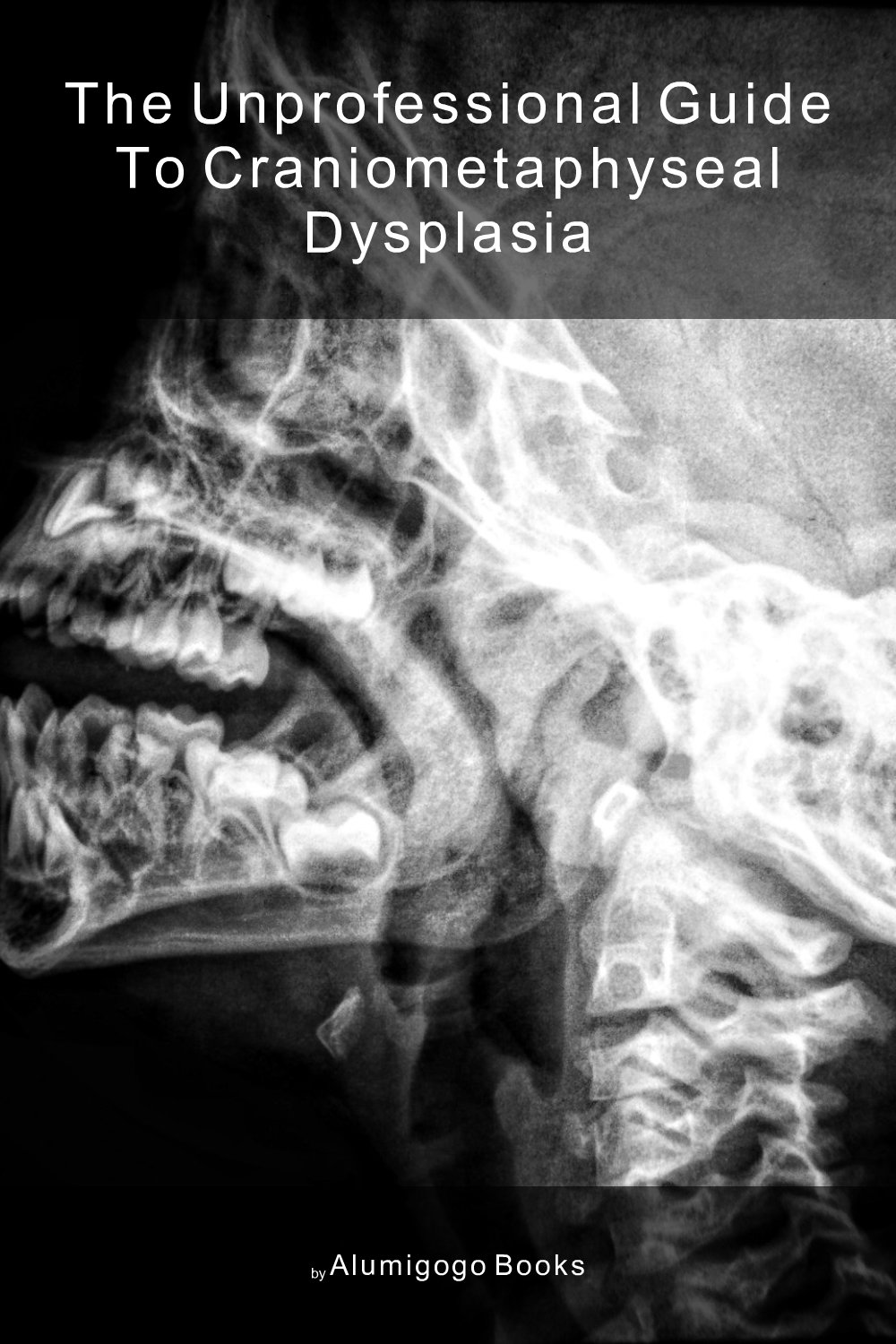 Cover of The Unprofessional Guide to craniometaphyseal dysplasia