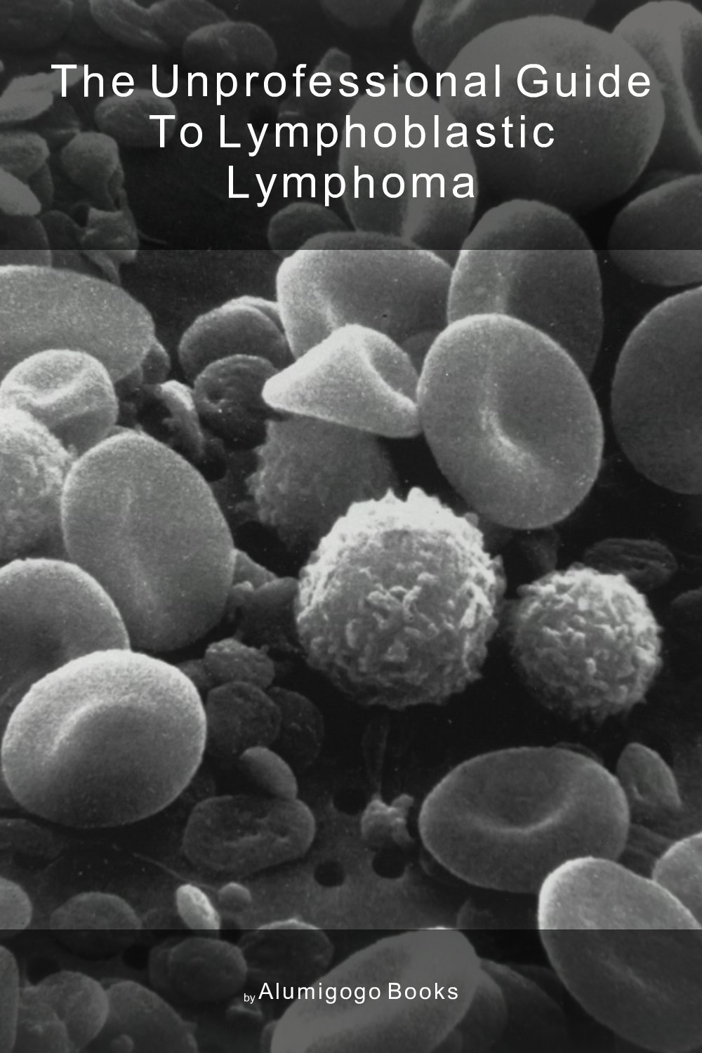 Cover of The Unprofessional Guide to lymphoblastic lymphoma