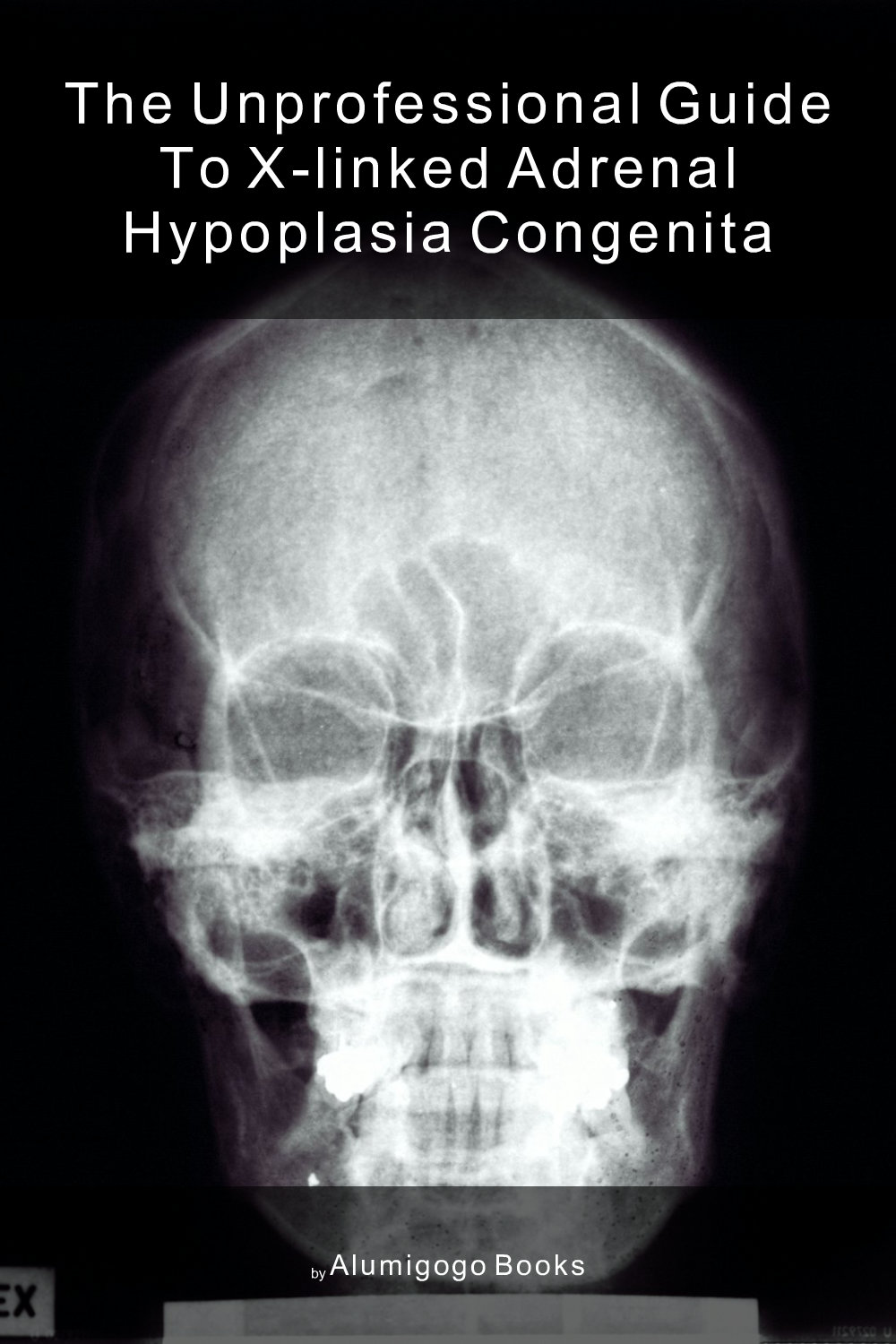 Cover of The Unprofessional Guide to X-linked adrenal hypoplasia congenita