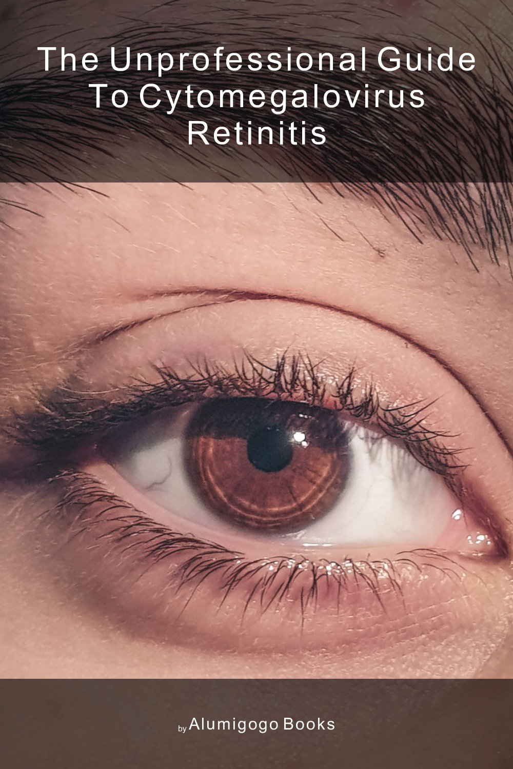 Cover of The Unprofessional Guide to Cytomegalovirus retinitis
