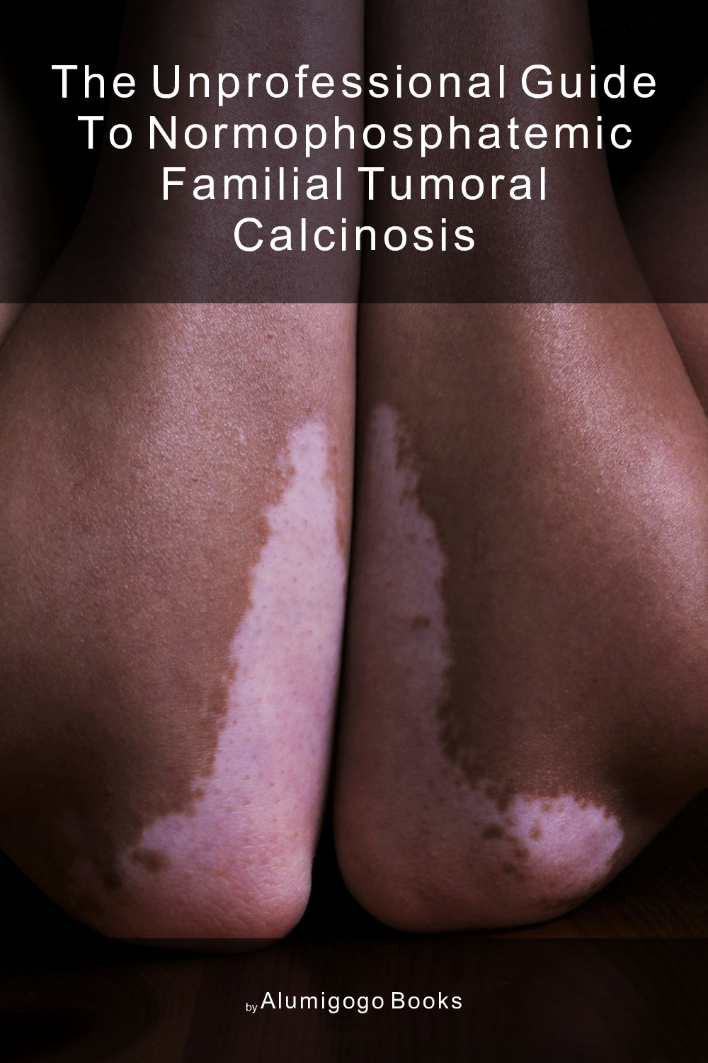 Cover of The Unprofessional Guide to normophosphatemic familial tumoral calcinosis