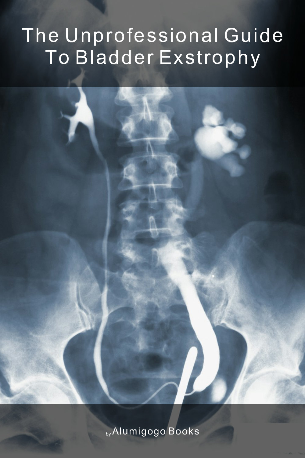 Cover of The Unprofessional Guide to bladder exstrophy